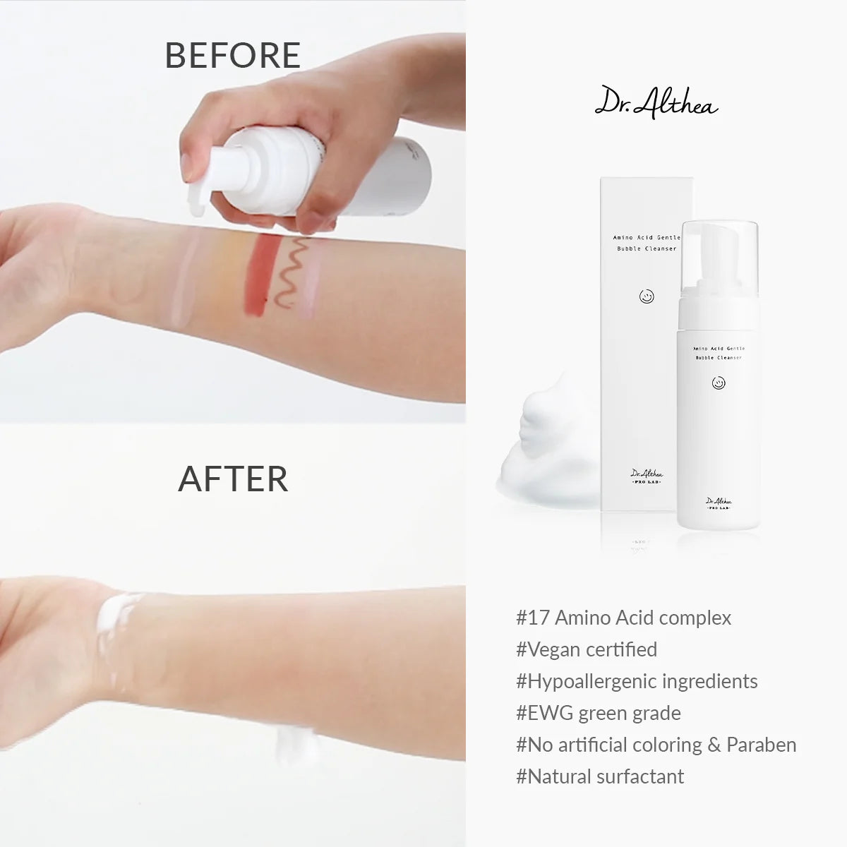 Before and after comparison of a skin treatment with Dr. Althea products.