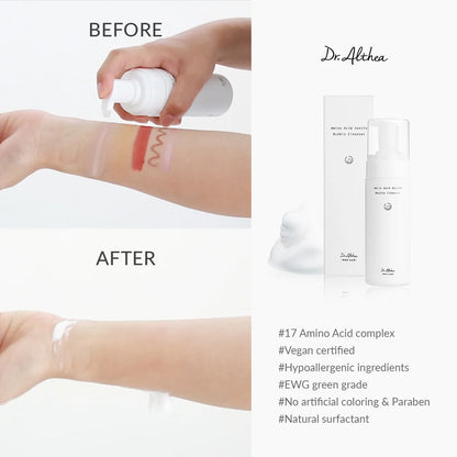 Before and after comparison of a skin treatment with Dr. Althea products.