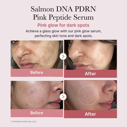 MEDICUBE PDRN Pink Peptide Serum (30ml)