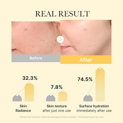 MEDICUBE Kojic Acid Turmeric Brightening Gold Jelly Gel Mask (4ea)