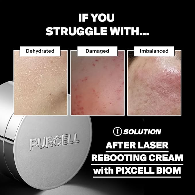 Purcell cream container with skin condition illustrations and text on a black background