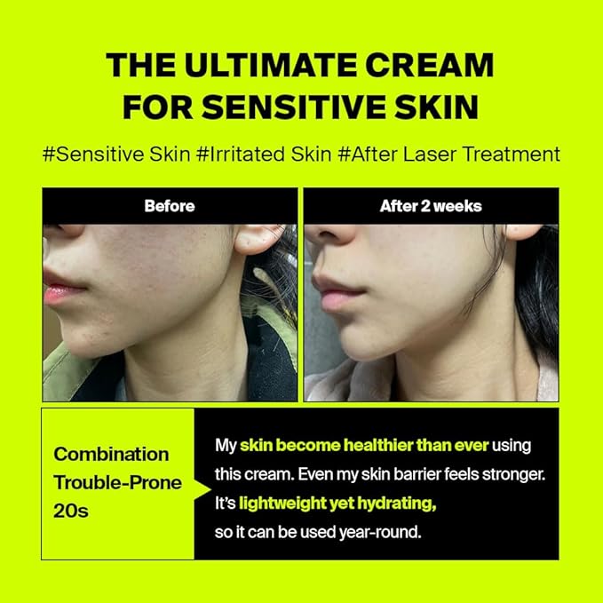 Advertisement for a cream for sensitive skin with 'Before' and 'After' results on a bright yellow background.