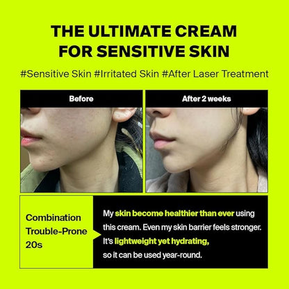 Advertisement for a cream for sensitive skin with 'Before' and 'After' results on a bright yellow background.