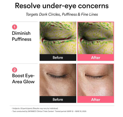 Advertisement for eye cream showing before and after effects on dark circles and puffiness.