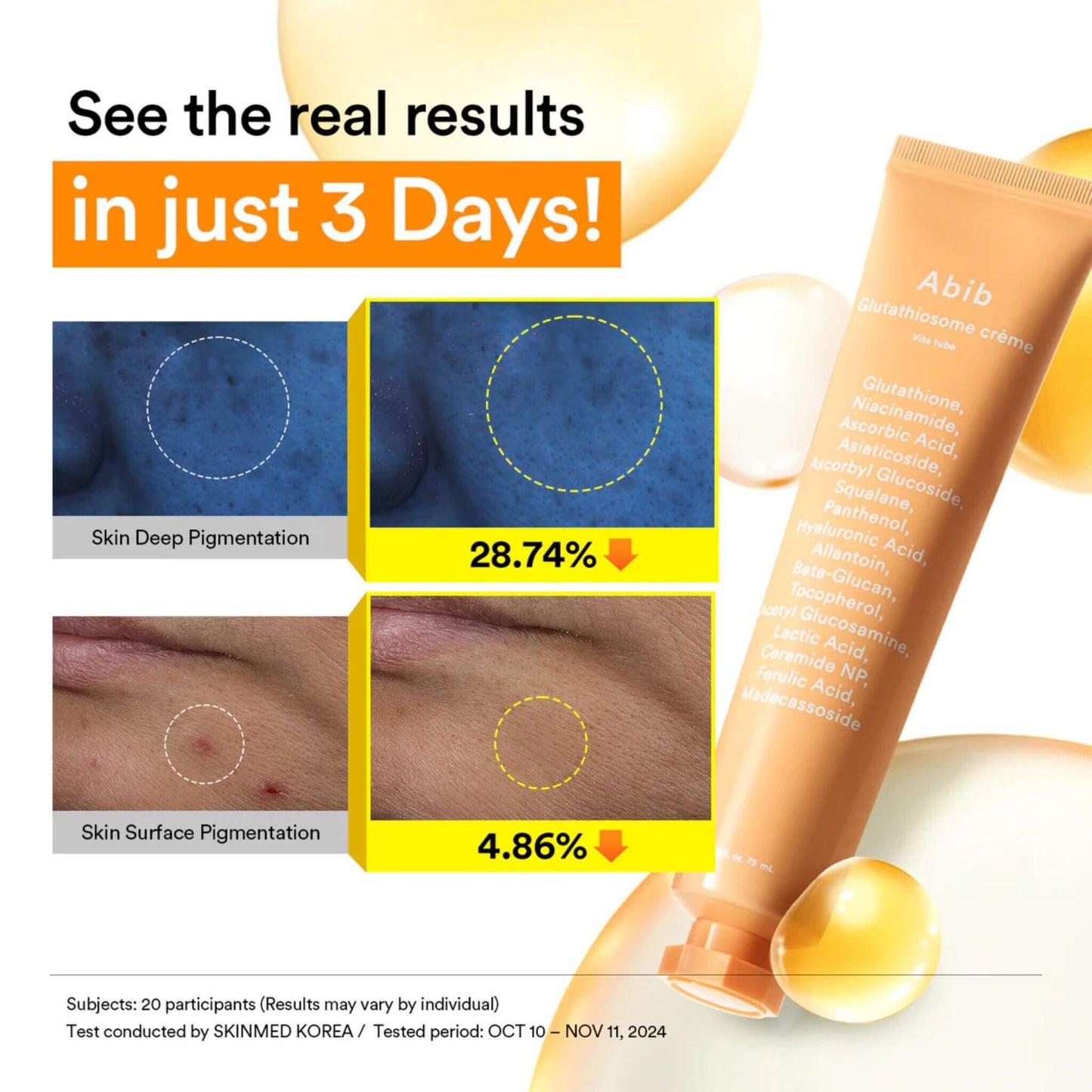 Promotional image of a skincare product with before-and-after results on skin pigmentation.