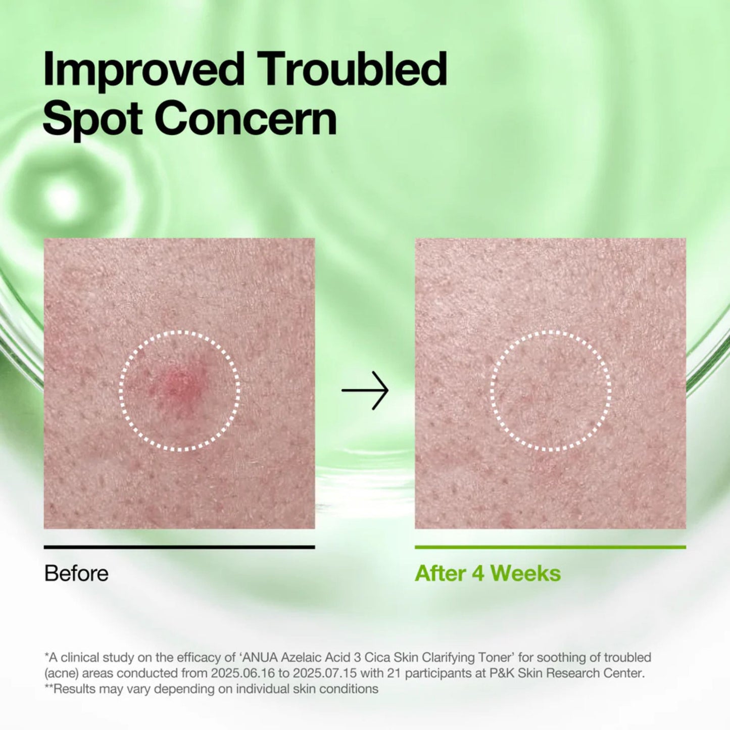 Before and after comparison of a troubled spot on skin with text about improved concern.