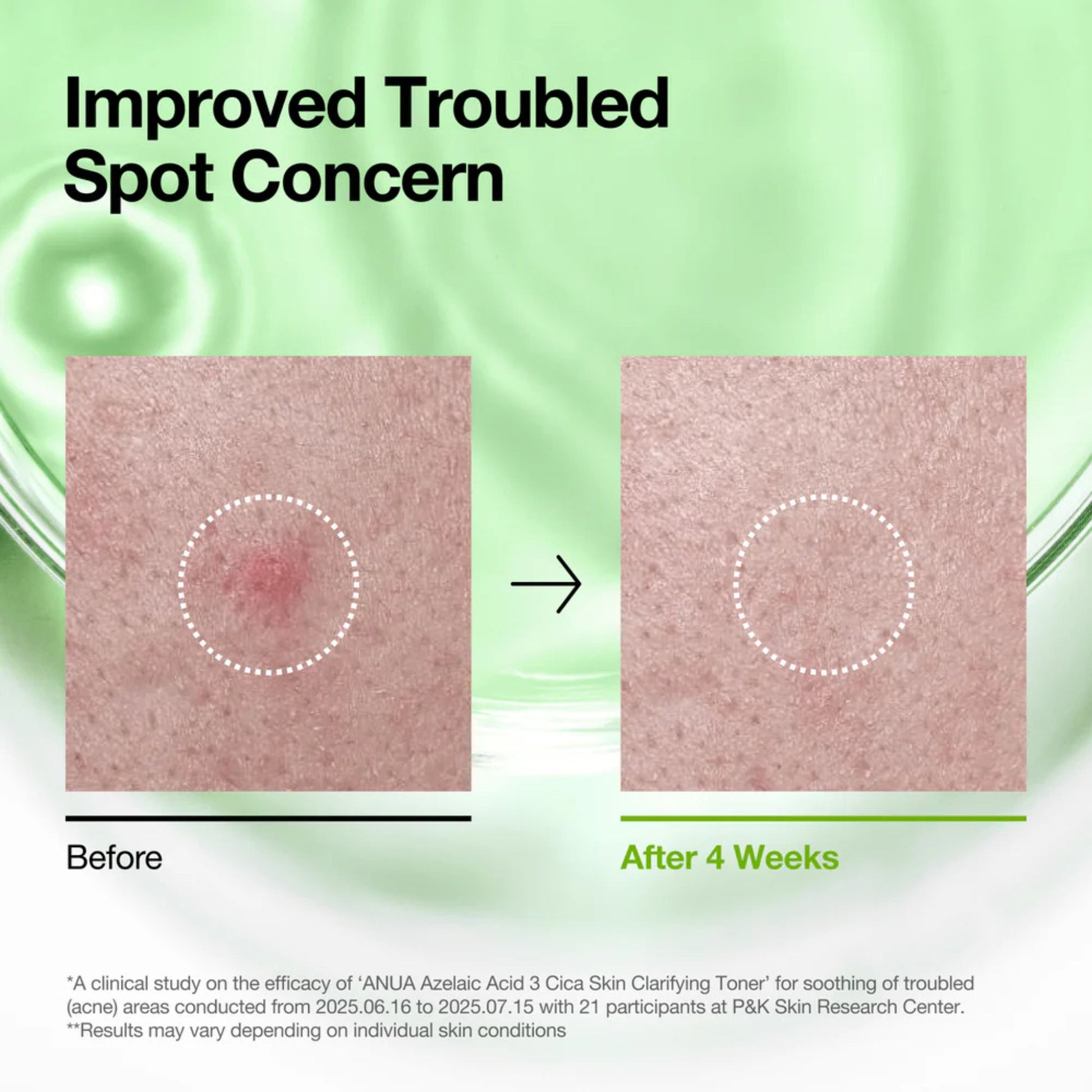 Before and after comparison of a troubled spot on skin with text about improved concern.
