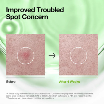 Before and after comparison of a troubled spot on skin with text about improved concern.