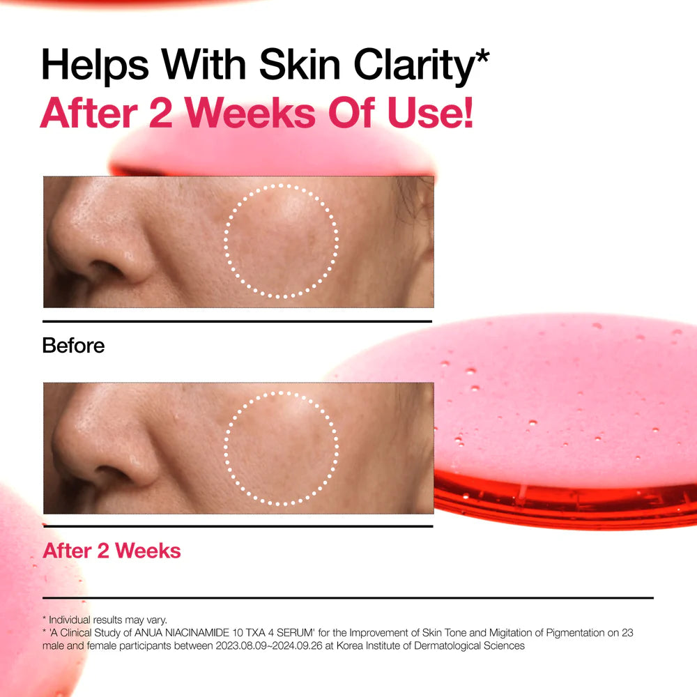 ANUA Niacinamide 10% + TXA 4% Serum (30 ml)