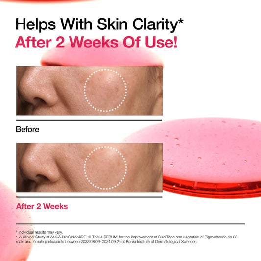 ANUA Niacinamide 10% + TXA 4% Serum (30 ml)