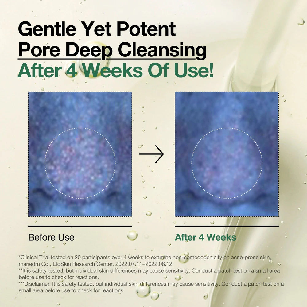 Before and after effect of a pore deep cleansing product on skin texture.