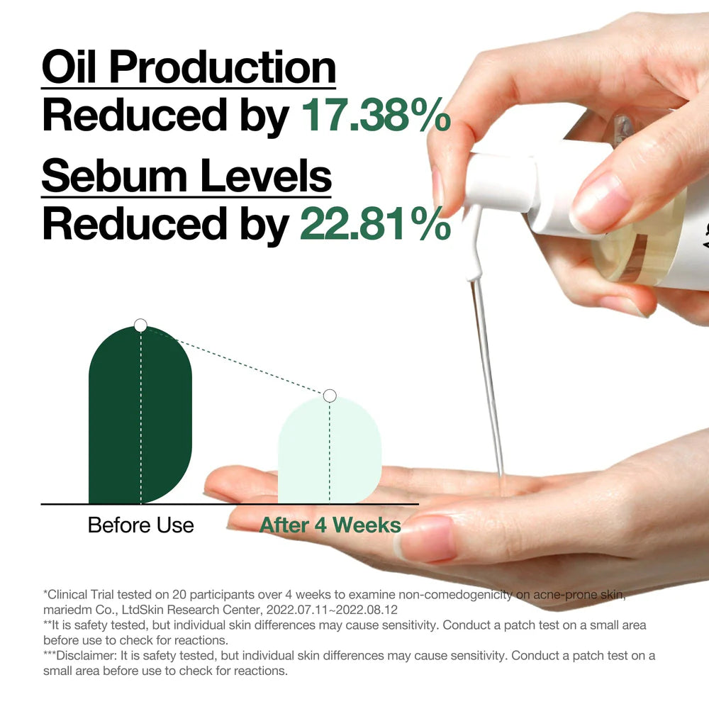Hand holding a dropper with text about oil production and sebum levels reduction, shown before and after use.
