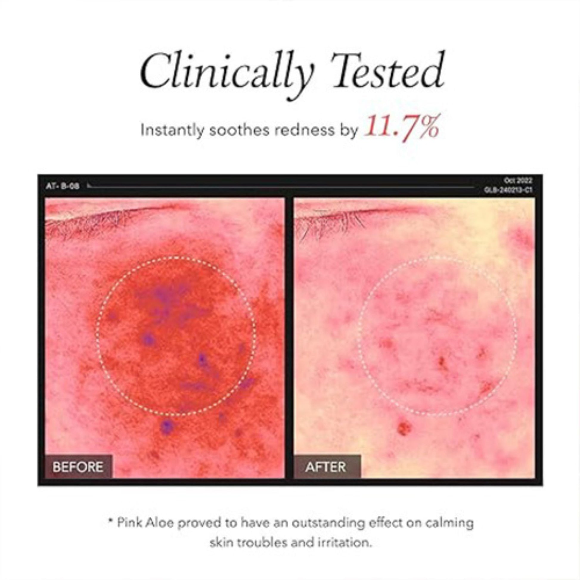Before and after comparison of skin redness with clinical testing results on a white background.