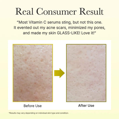 Before and after使用维生素C精华的皮肤效果对比图