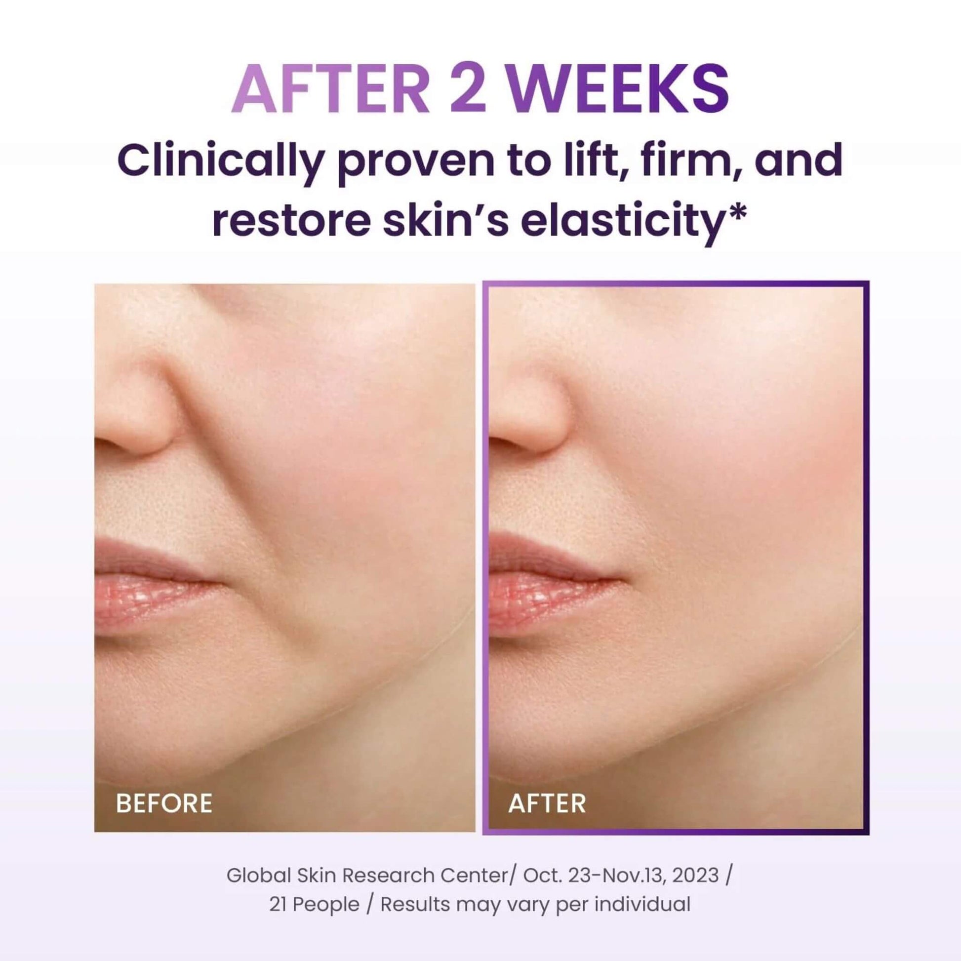 Before and after comparison of skin elasticity with text indicating clinical proven results.