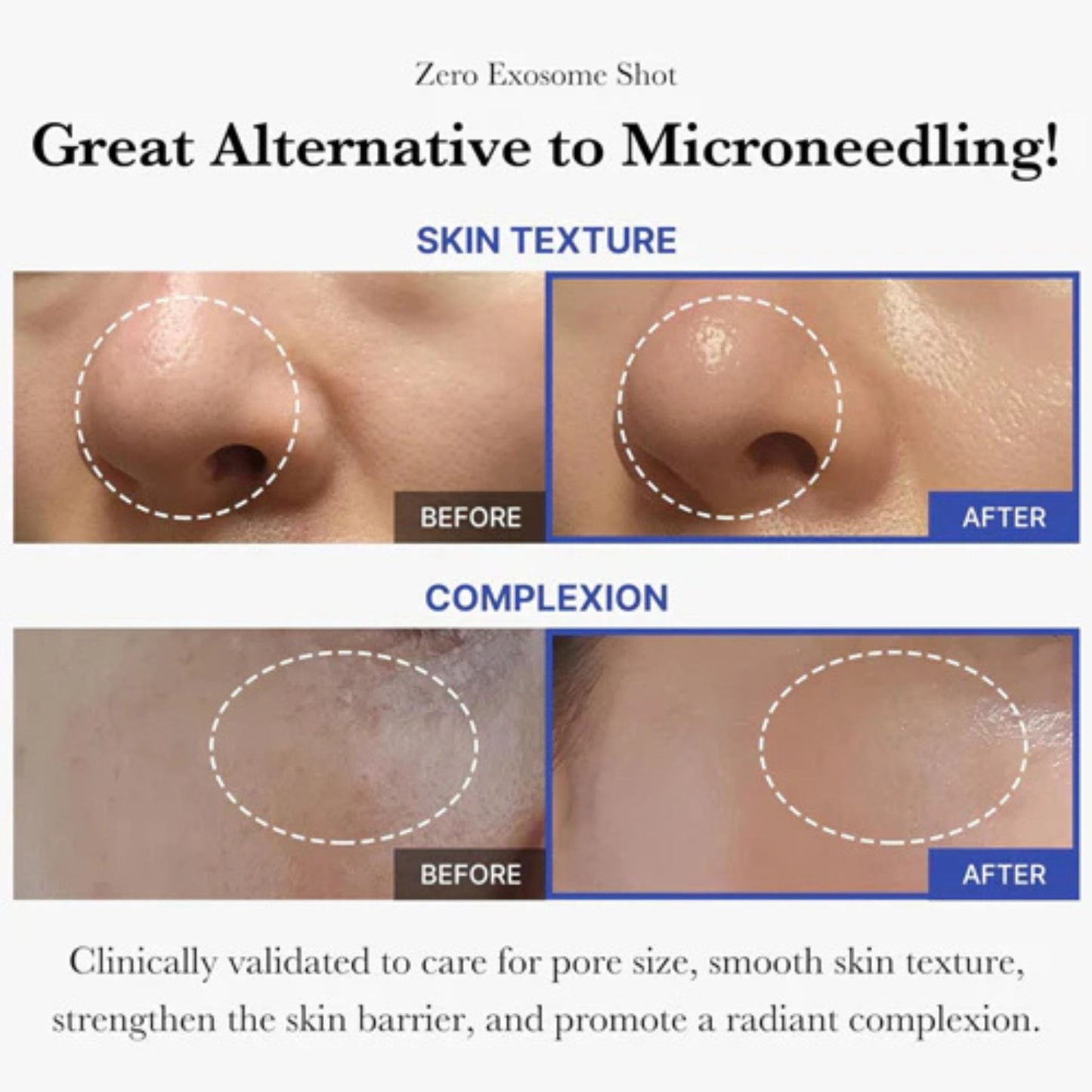 Before and after comparison of skin texture and complexion with text highlighting benefits.