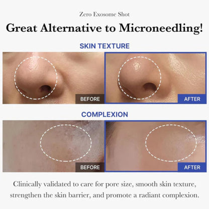 Before and after comparison of skin texture and complexion with text highlighting benefits.