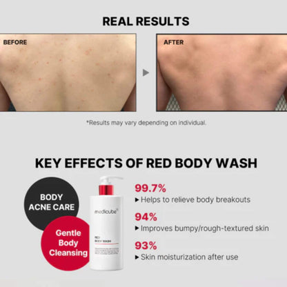 Advertisement for Red Body Wash showing before and after effects on skin with product details.