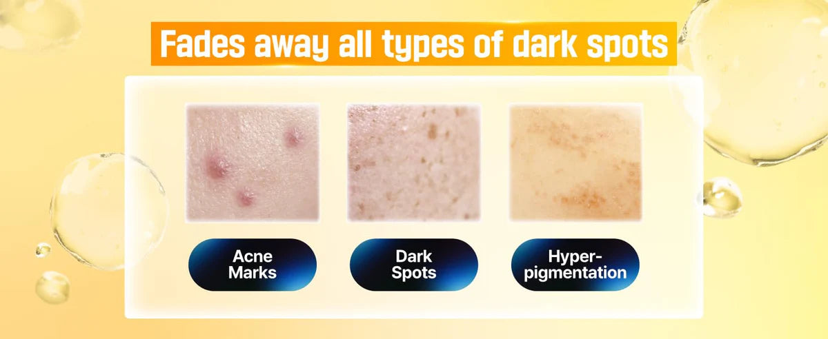 NUMBUZIN No.5 Vitamin Concentrated Serum – Brightening & Hyperpigmentation Treatment (30ml)