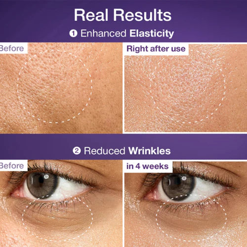 Before and after effects of a skincare product on skin texture and wrinkles.