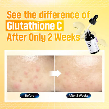 Advertisement for Glutathione C showing before and after effects on skin with a bottle of the product.