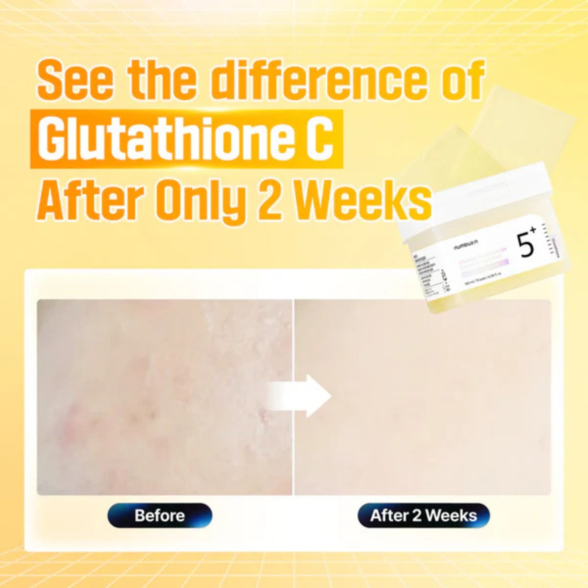 Advertisement for Glutathione C showing before and after effects on skin with a yellow background.