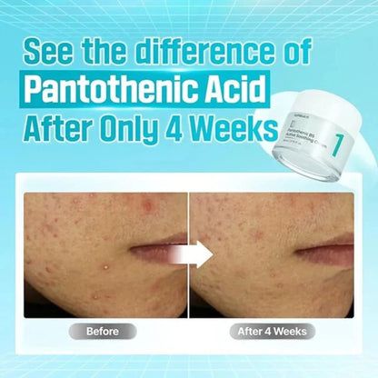 Before and after comparison of skin treatment with pantothenic acid, showing a bottle of cream.