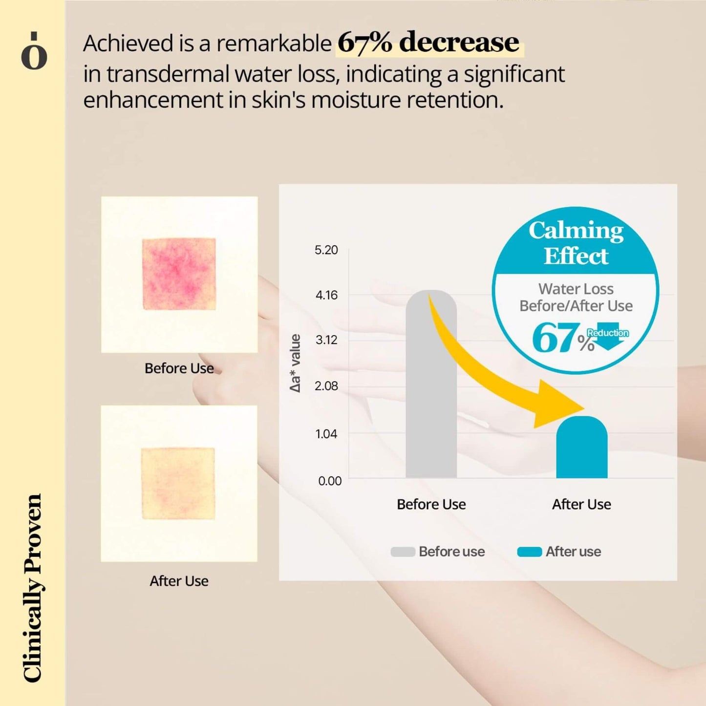 Graph showing a 67% decrease in transdermal water loss with a calming effect, before and after use comparison.