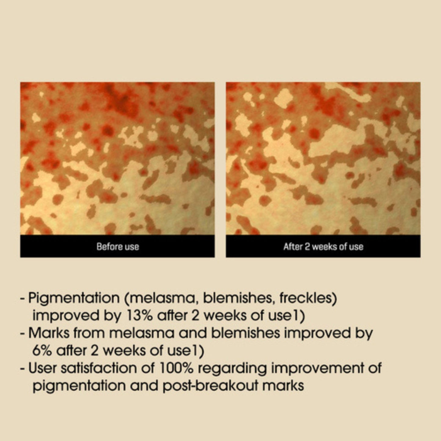 Before and after comparison of skin texture with text indicating improvement after use.