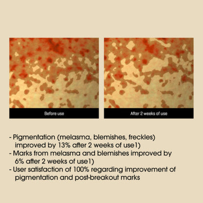 Before and after comparison of skin texture with text indicating improvement after use.