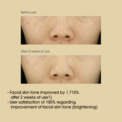 Before and after comparison of facial skin tone improvement with text on a beige background
