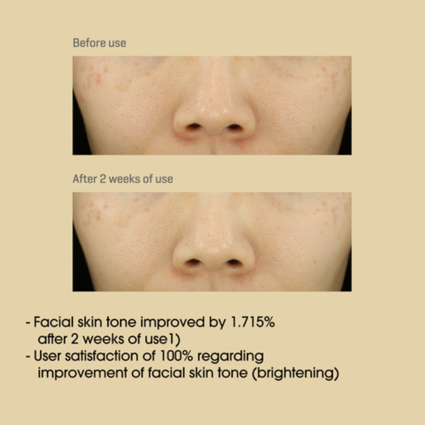 Before and after comparison of facial skin tone improvement with text on a beige background