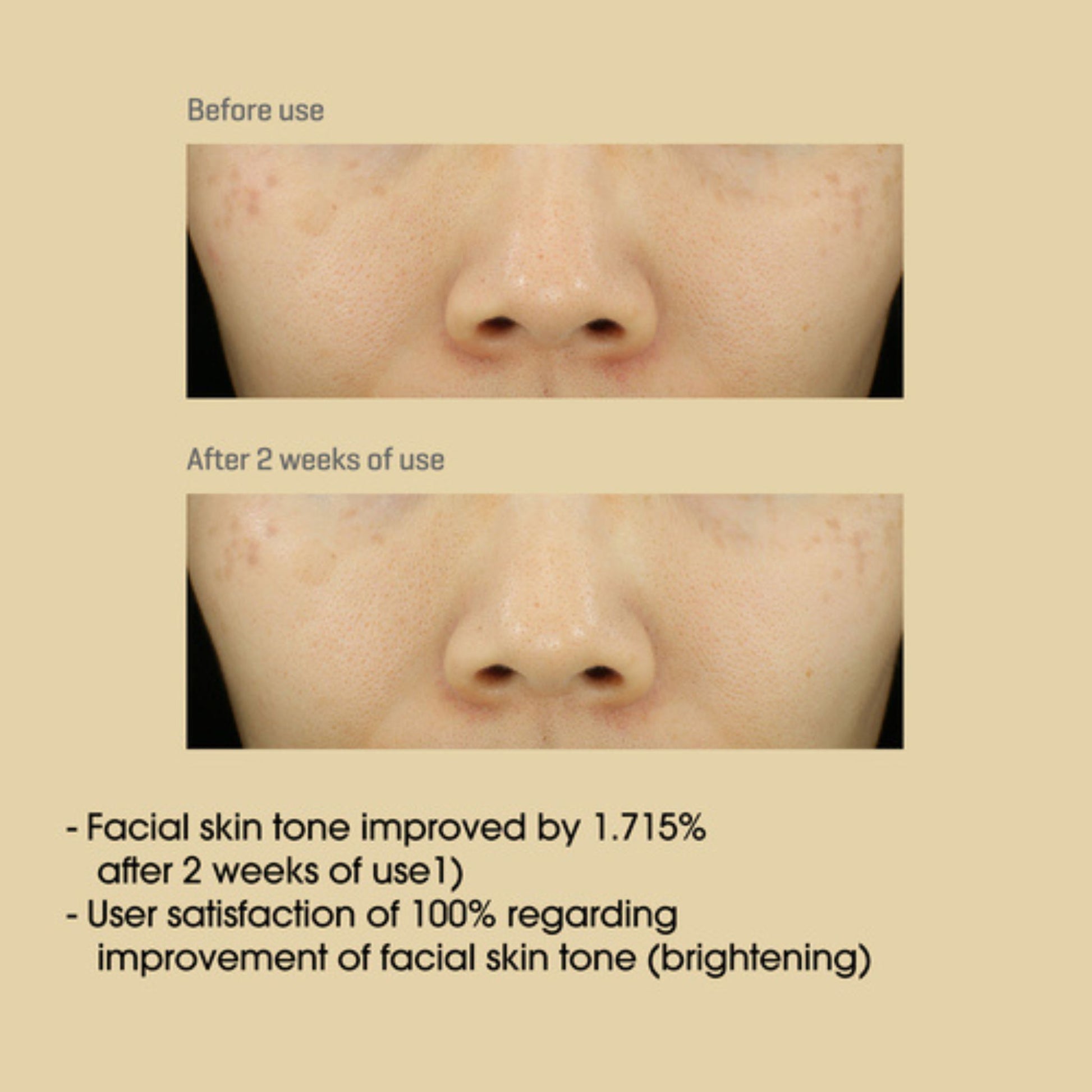Before and after comparison of facial skin tone improvement with text on a beige background