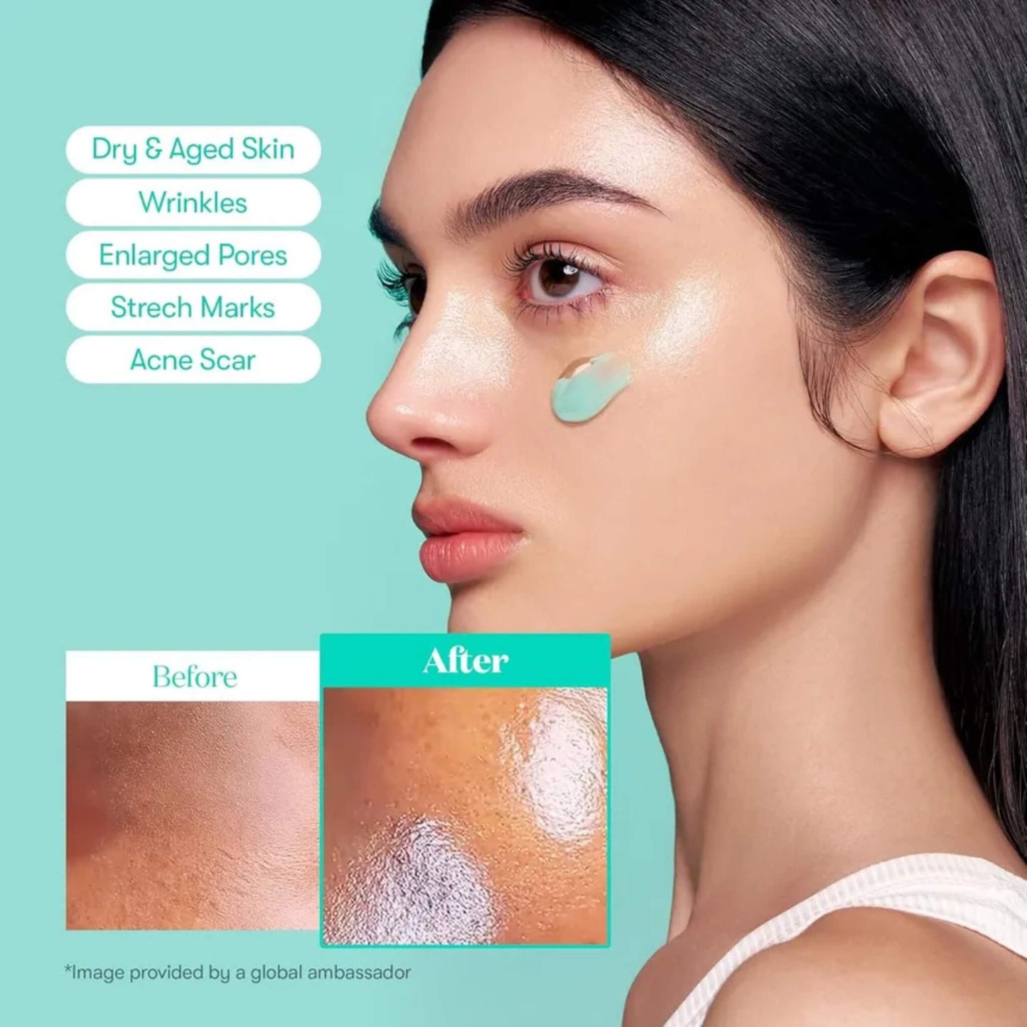 Woman applying skincare product with 'Before' and 'After' comparisons on a teal background